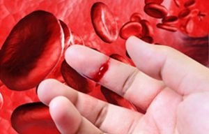 Caja invertirá $1,4 millones en tratamiento para personas hemofílicas