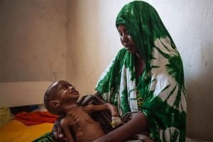 Número de niños desnutridos en Somalia aumenta un 50% en sólo cuatro meses