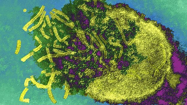 América se convierte en la primer región del Mundo en estar libre de de sarampión