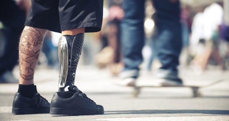 Personas amputadas realizarán pasarela