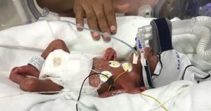 Oficinas centrales de CCSS se iluminarán de morado por Día Mundial del Niño Prematuro