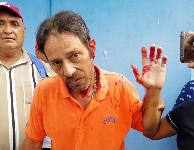 Policía agrede a pescador que se manifestaba frente a Casa Presidencial