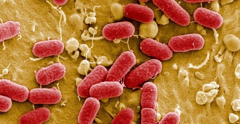 La “pandemia silenciosa”: bacterias resistentes a antibióticos