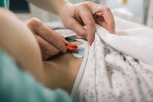 Área de Salud Alajuela Sur programa más de 3 mil electrocardiogramas para reducir lista de espera