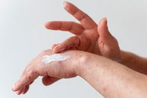 ¿Padece dermatitis atópica? Emprendimiento crea innovadora crema con extracto de papa