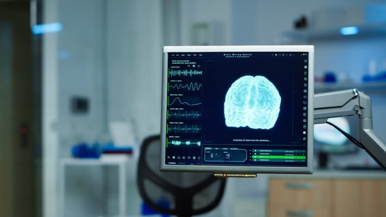 Mapeo de ondas cerebrales contribuye a personalizar el tratamiento contra la epilepsia
