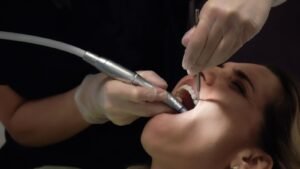 Científicos analizan posible relación entre enfermedad de las encías y padecimientos como Alzheimer y diabetes